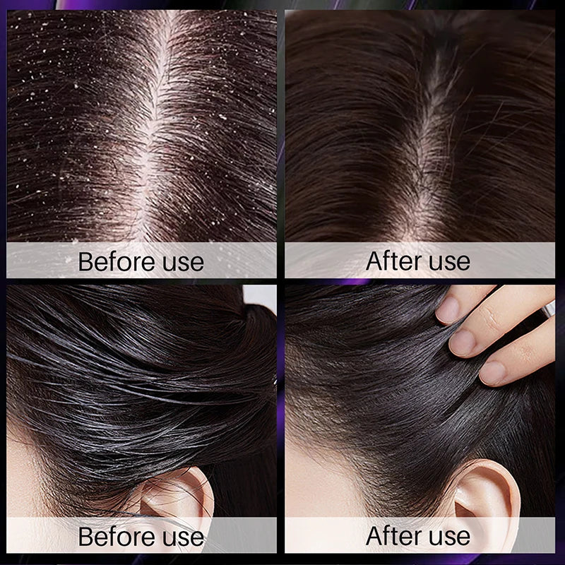 Hair Growth Thickening Shampoo