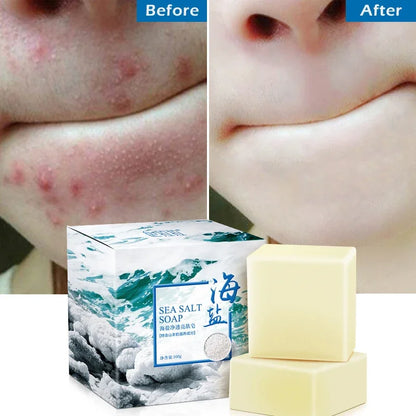 Sea Salt Whitening Soap