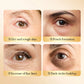 Collagen Gel Dark Circles Remover Eye Patches